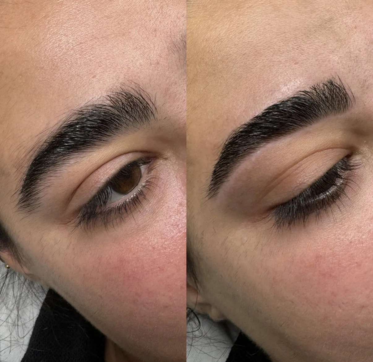 Comparativa de una ceja antes y después del tratamiento, con el vello peinado y definido